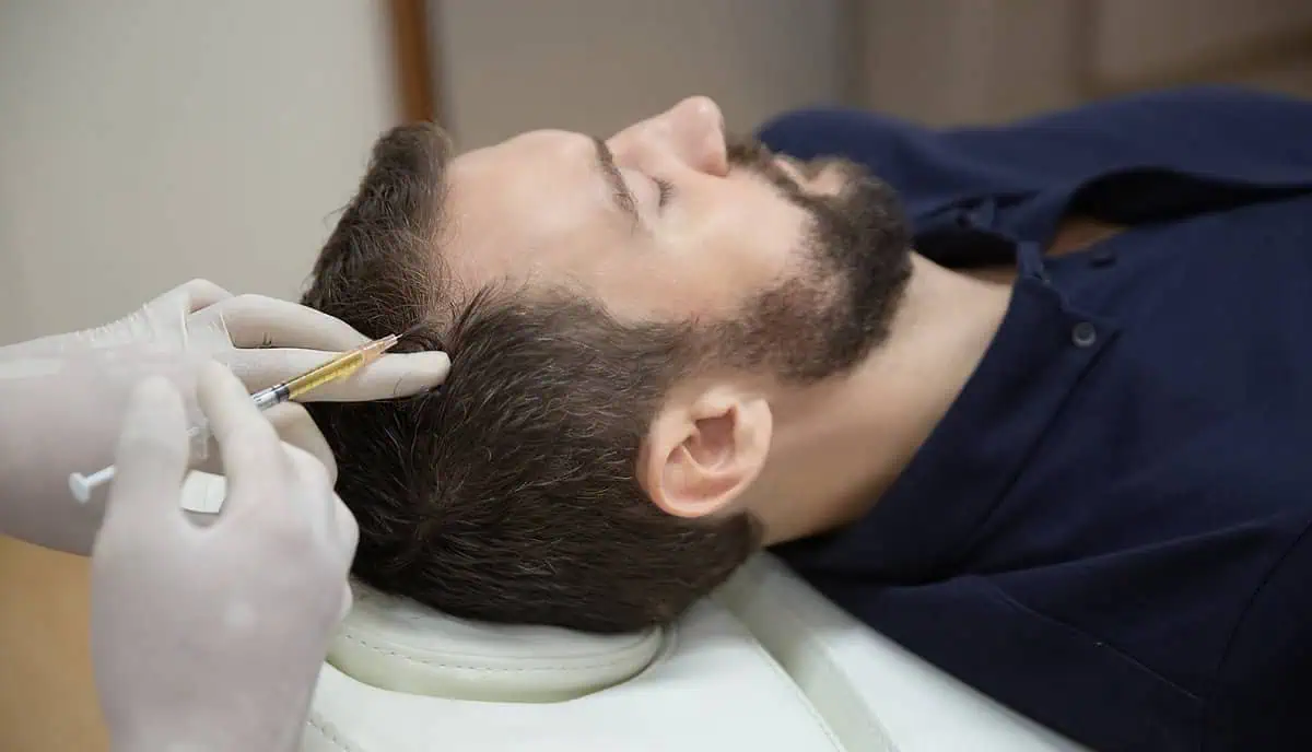 PRP Hair Restoration Treatment in Toronto, ON: Renovo Medspa