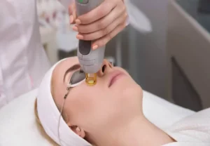 Laser Skin Resurfacing in Toronto, ON | Renovo Medical Spa