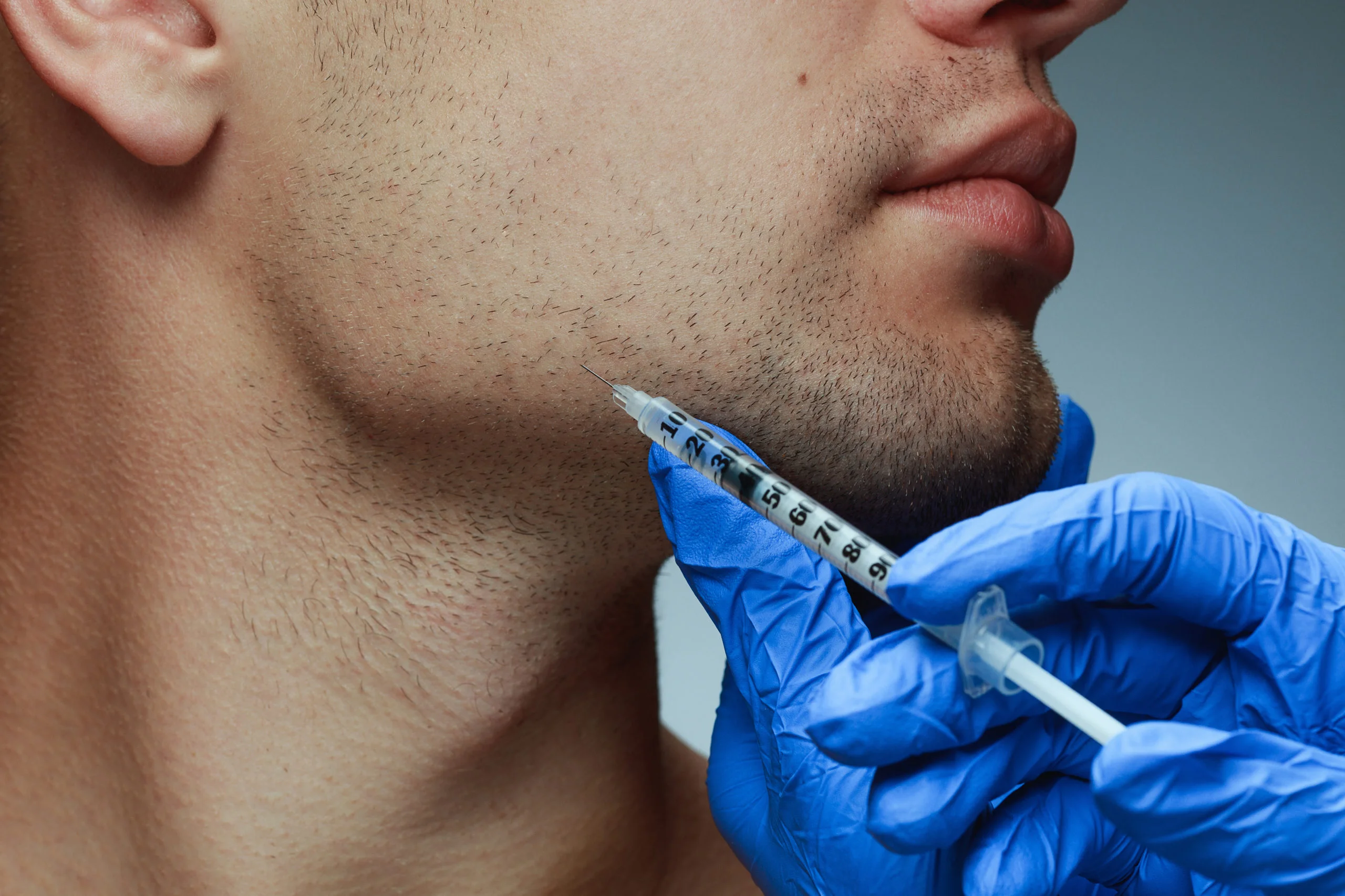 Botox for Men in Toronto, ON | Renovo Medical Spa