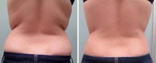 a woman's side and side view of a woman's belly