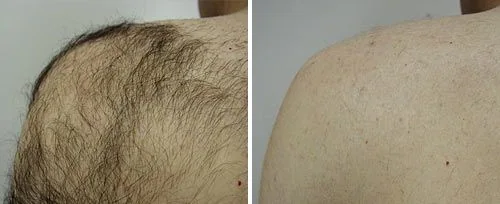 a close-up of a man's hairy chest