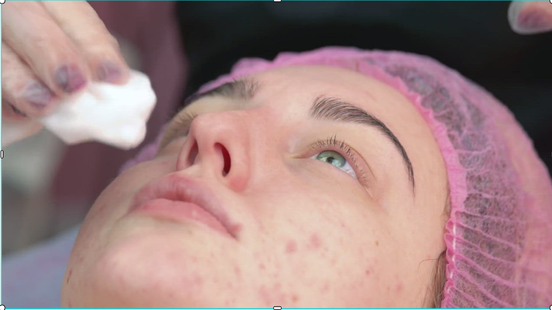 a person getting a facial treatment