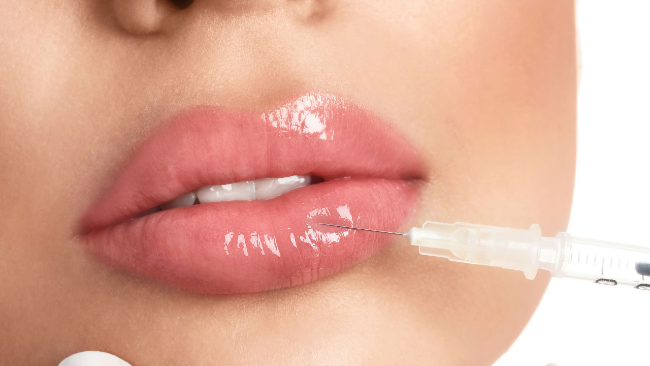 Lip Filler in Etobicoke