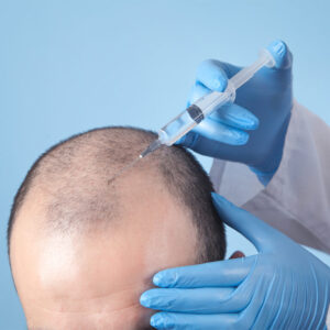 hair restoration treatment