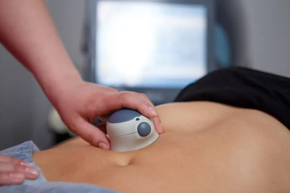 CoolSculpting